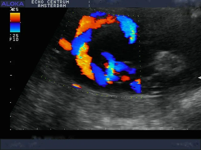 Céleste Laarman, kinderarts - neonatoloog