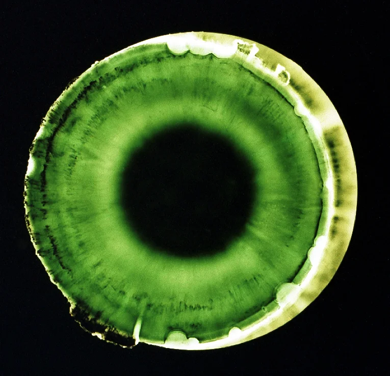 Zip 2, Penelope Davis, 2003, type c print, 50x50cm