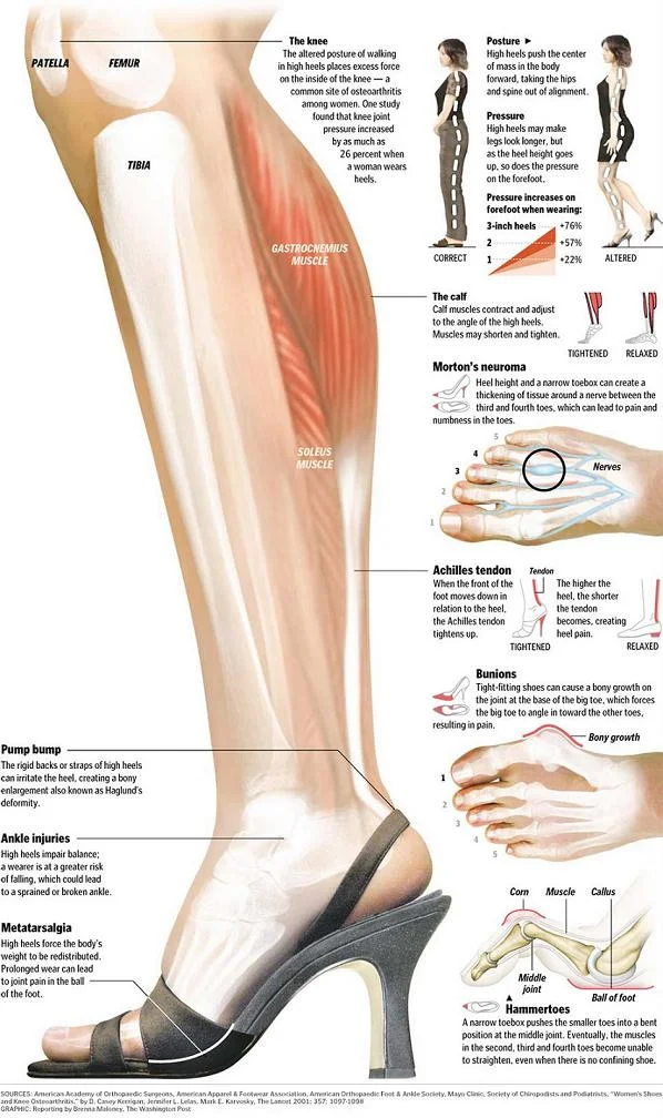 Some of the common conditions that develop as a result of wearing high heels too often.