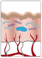 Normal Skin