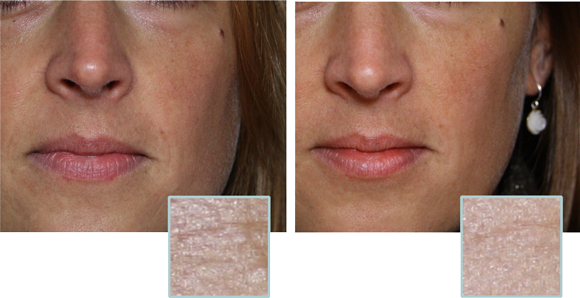 results in more even complexion