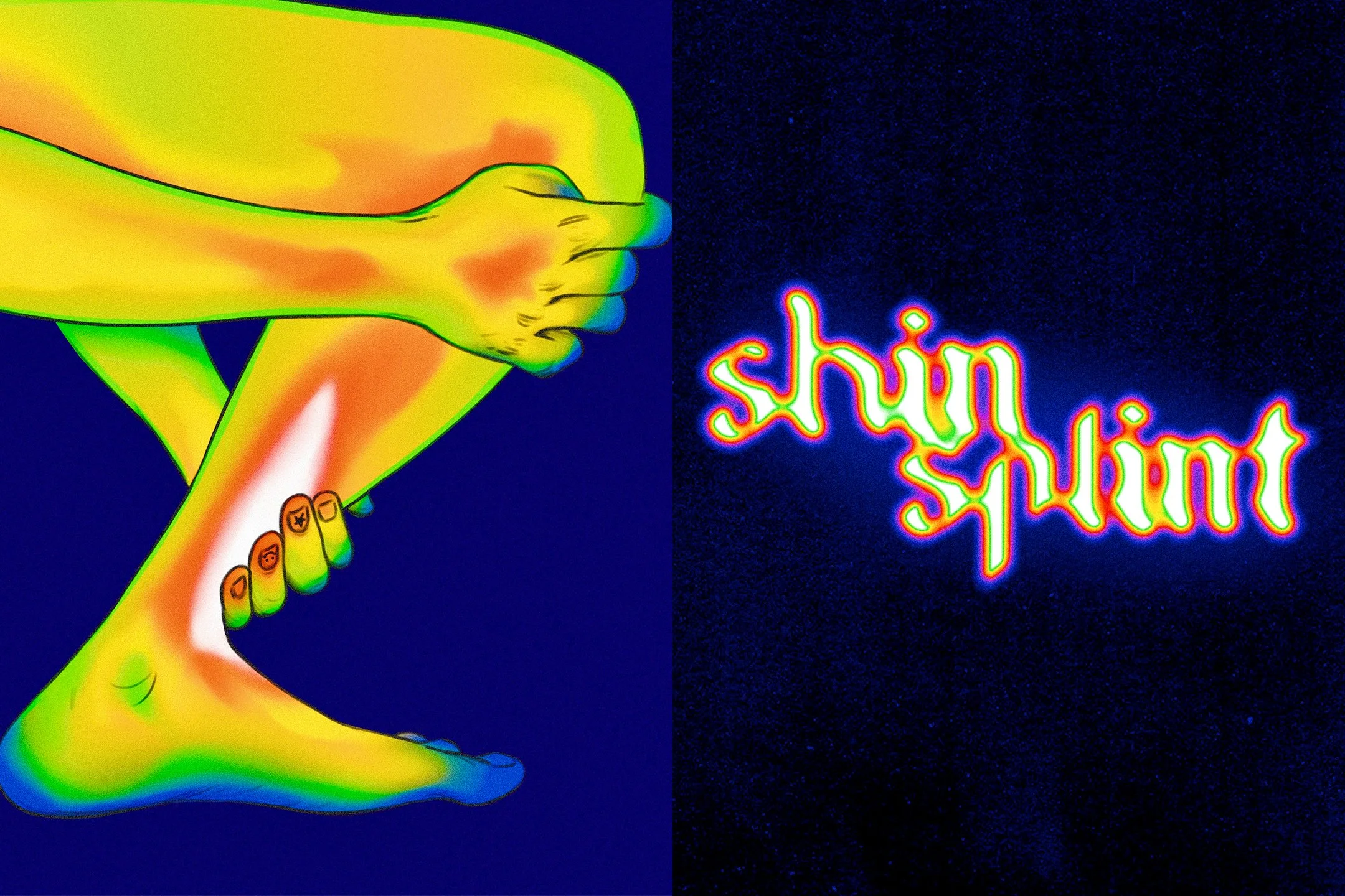 shin_splint_site.jpg