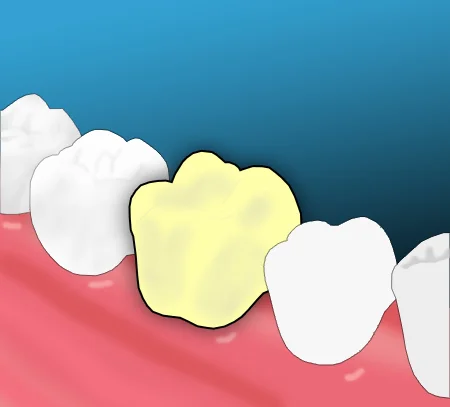 Damaged tooth identified