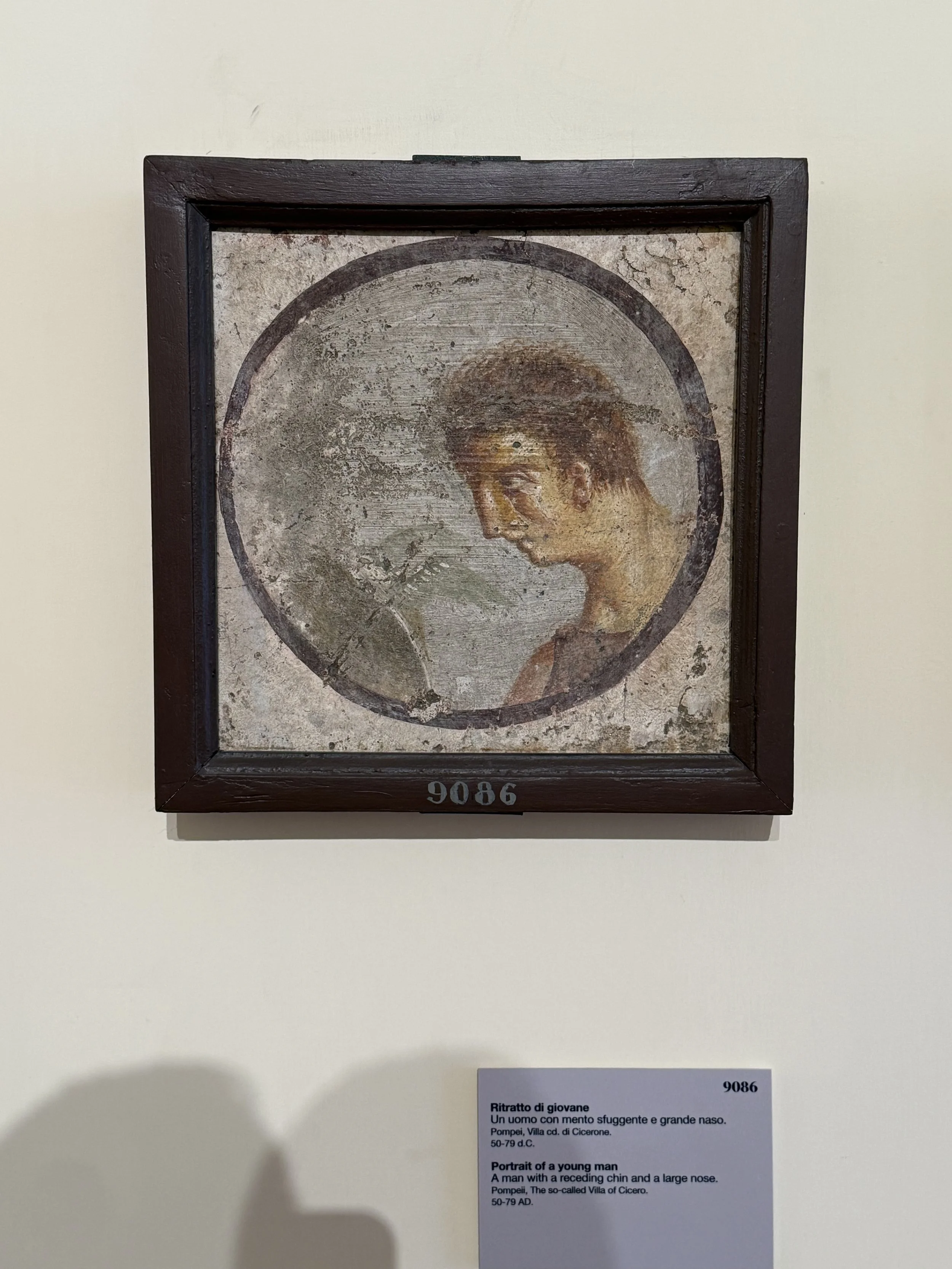 A portrait of a young man with a receding chin and large nose, from Pompeii, Villa of Cicerone, 50-79 AD.