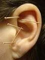 ear-acupuncture.jpg