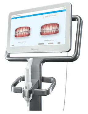 iTero Element Scanner