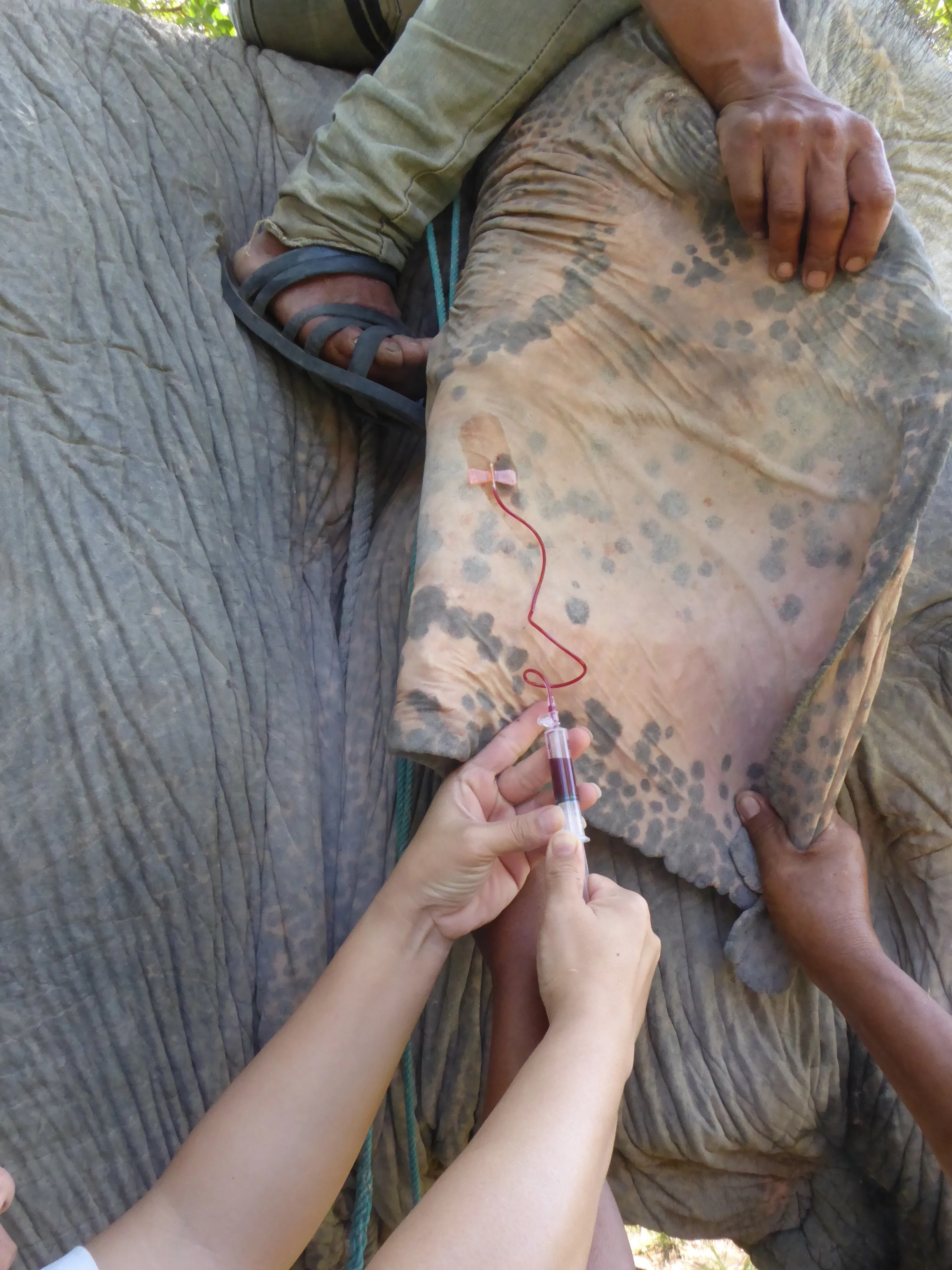 Taking a blood sample