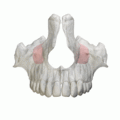 The maxillary sinus is highlighted in red