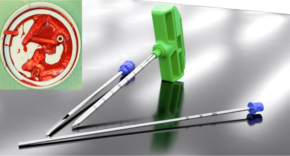 Office Joint Preservation:  Cutting Edge Biologics, Including New Intraosseous Therapies