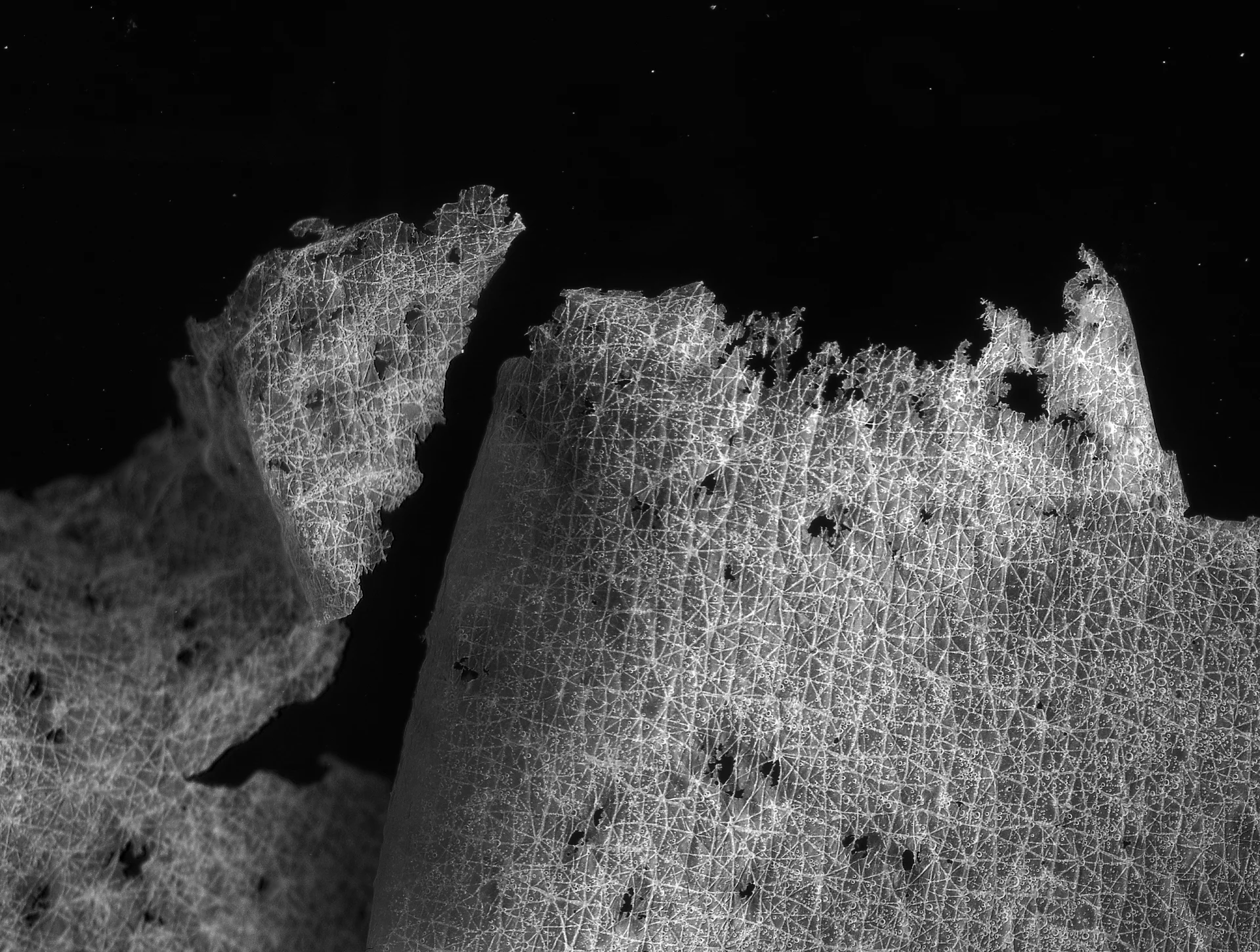 Skin Flake
