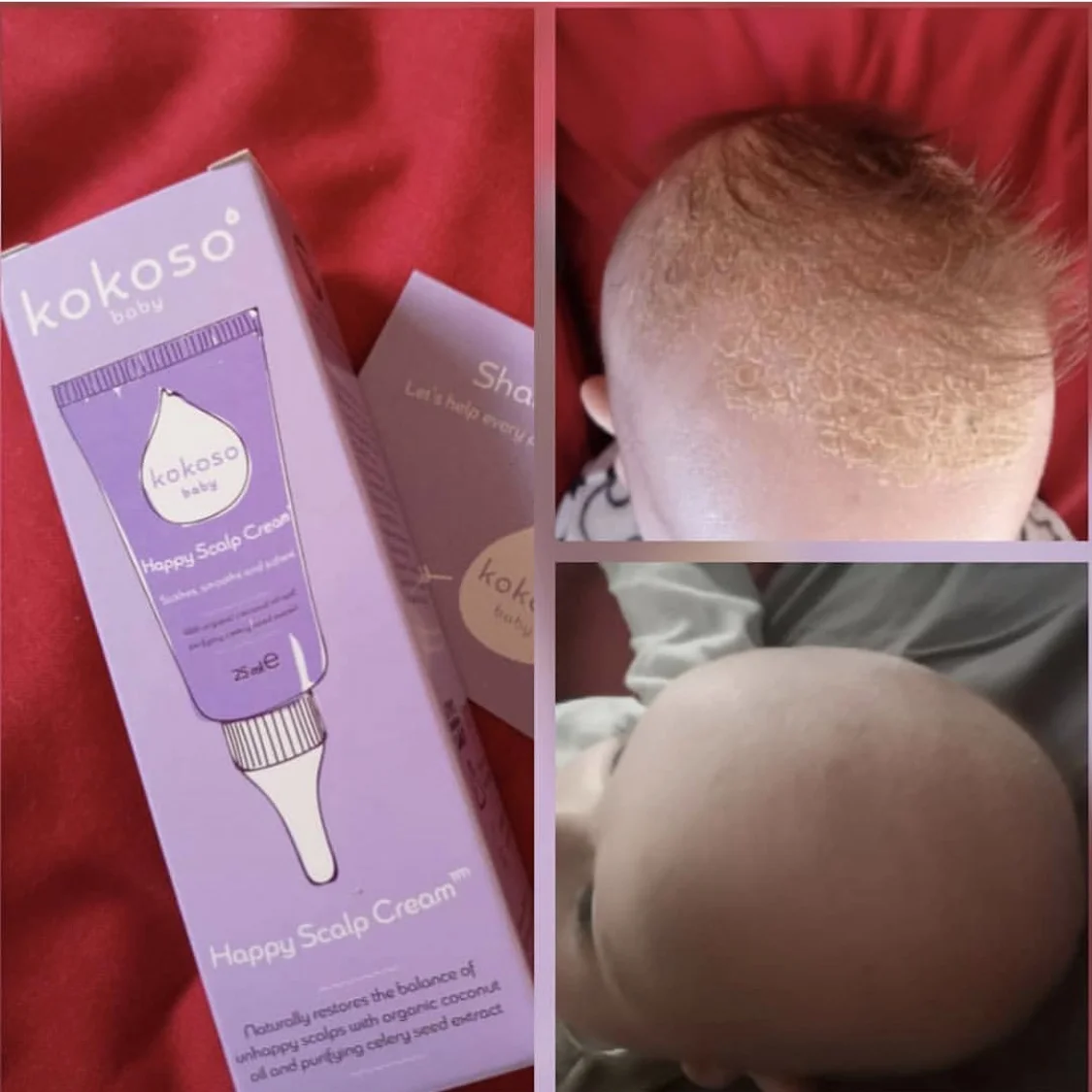 Happy Scalp before and after.jpg