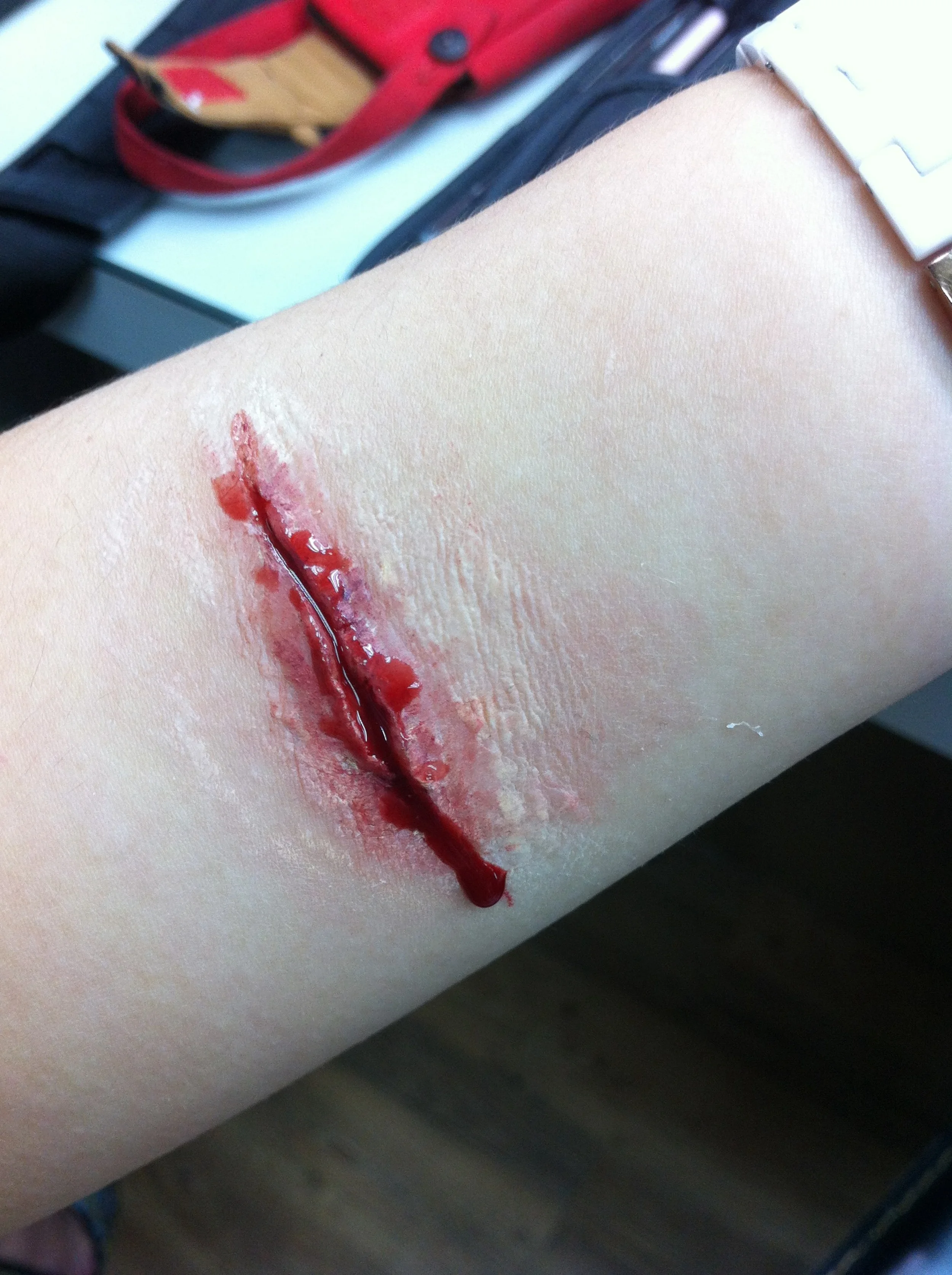Cut wound