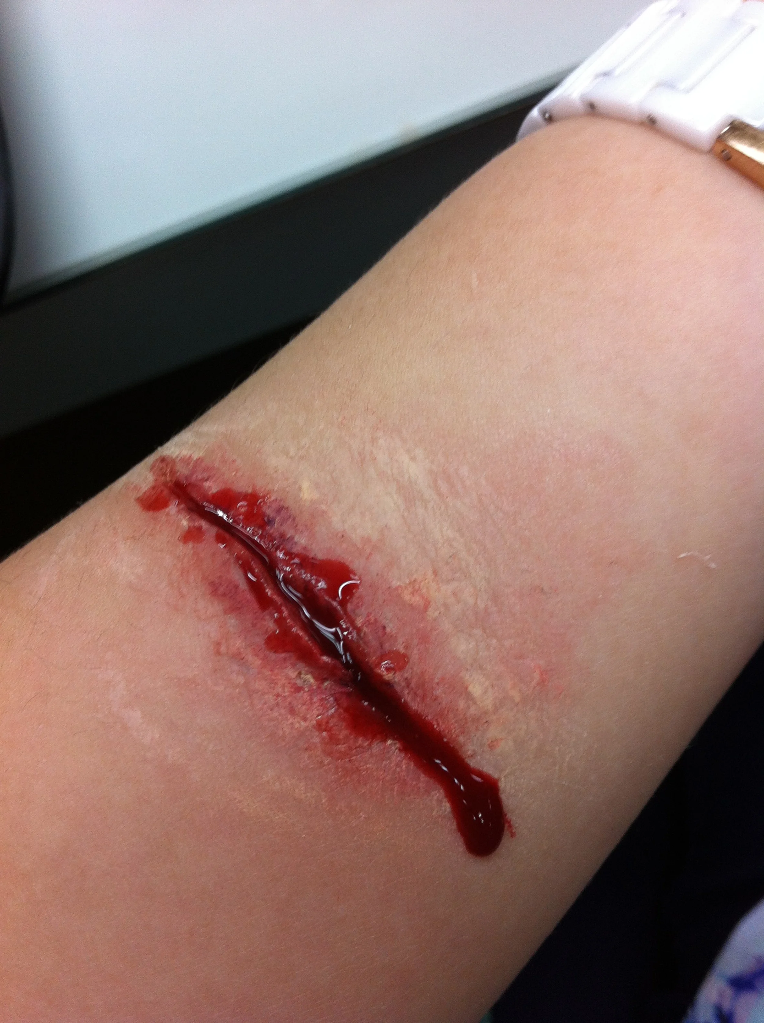 Cut wound 