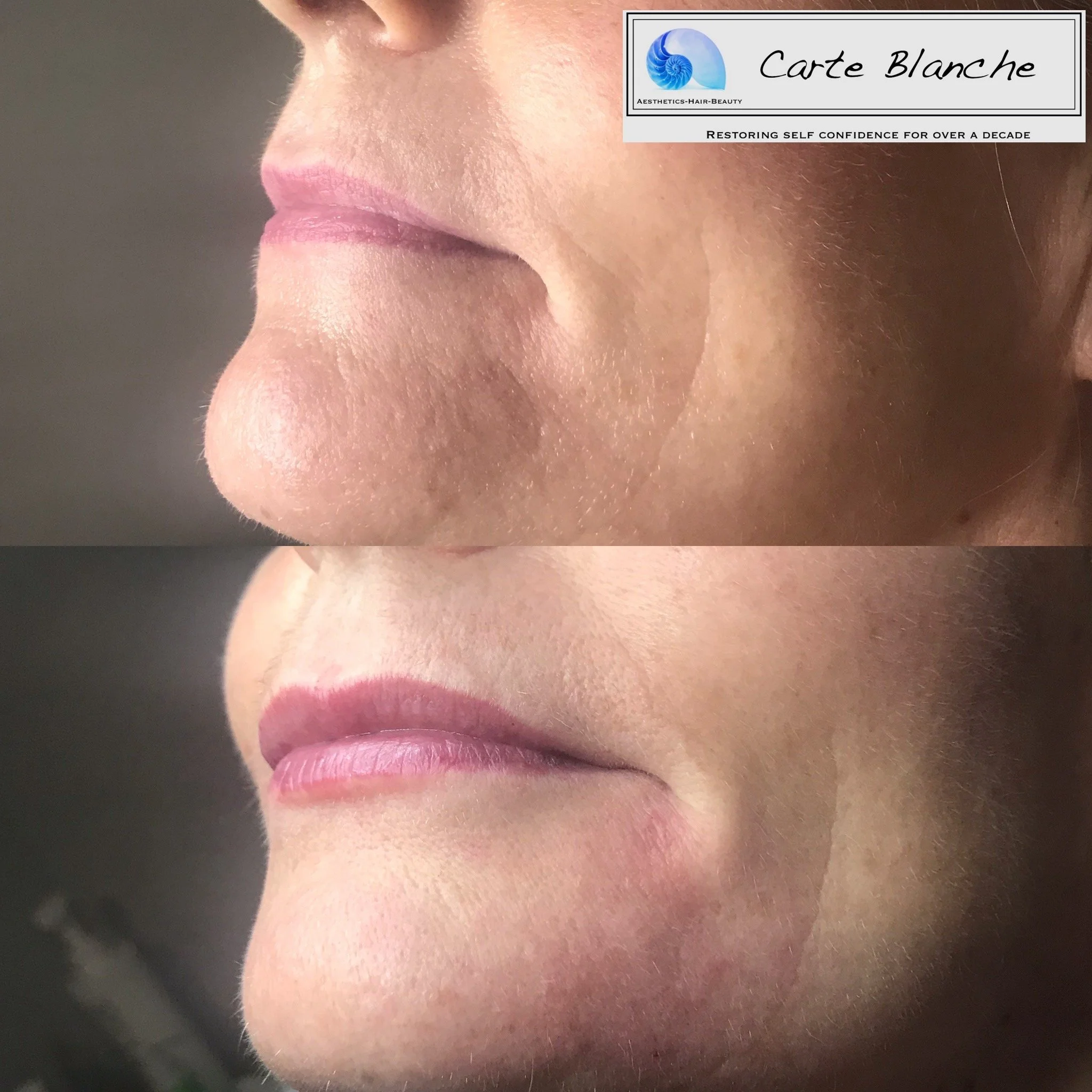 LipsRestored.jpeg