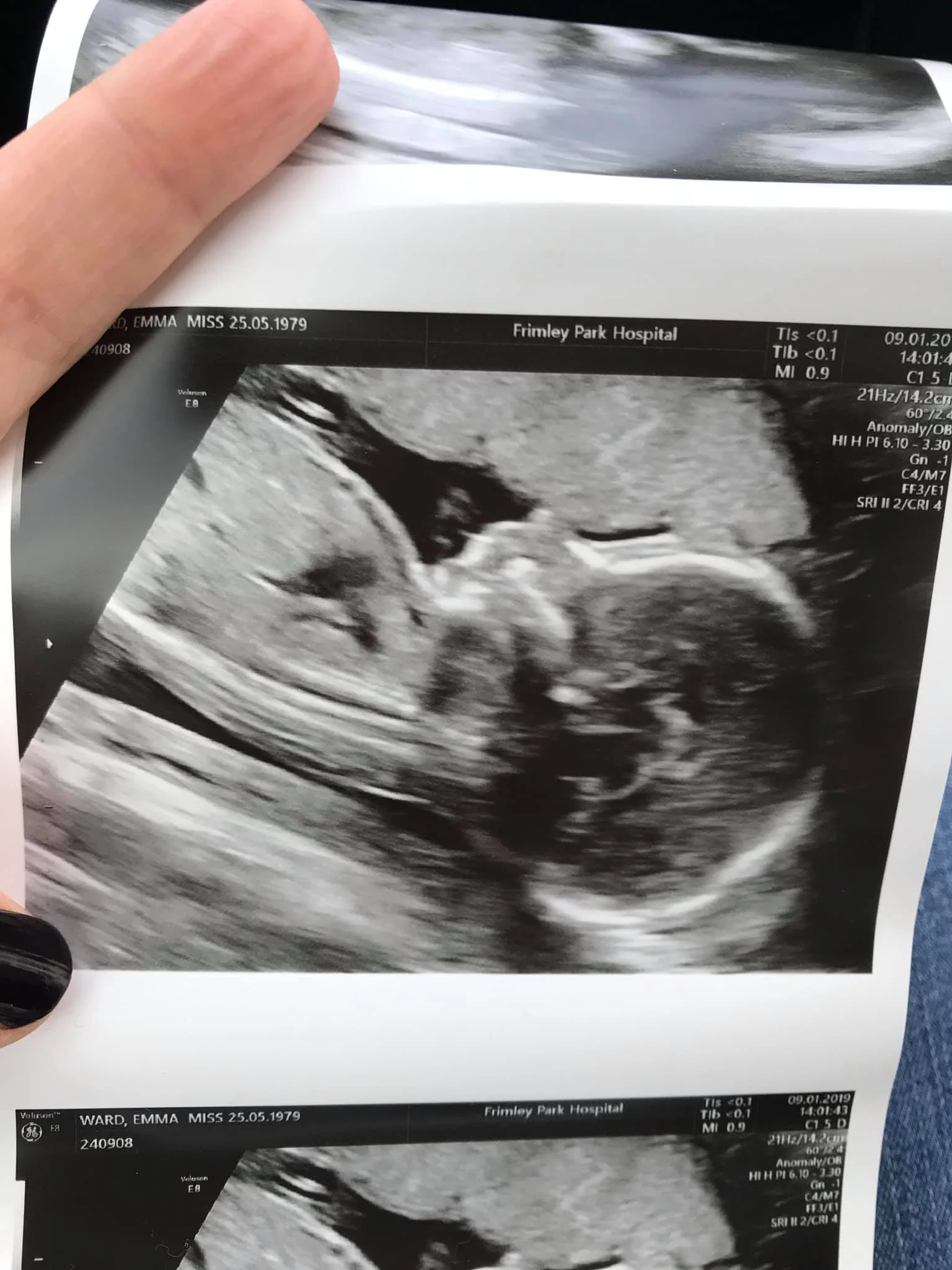 20 week scan.jpg