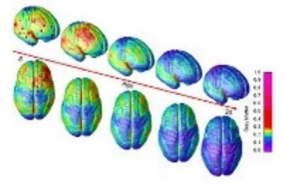 Image courtesy of the National Institute of Mental Health,
