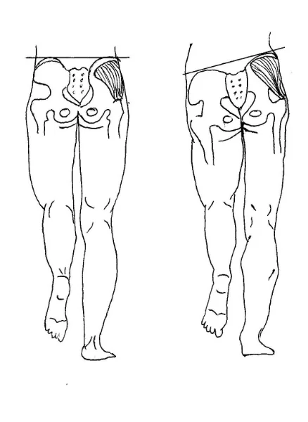 Pelvic List