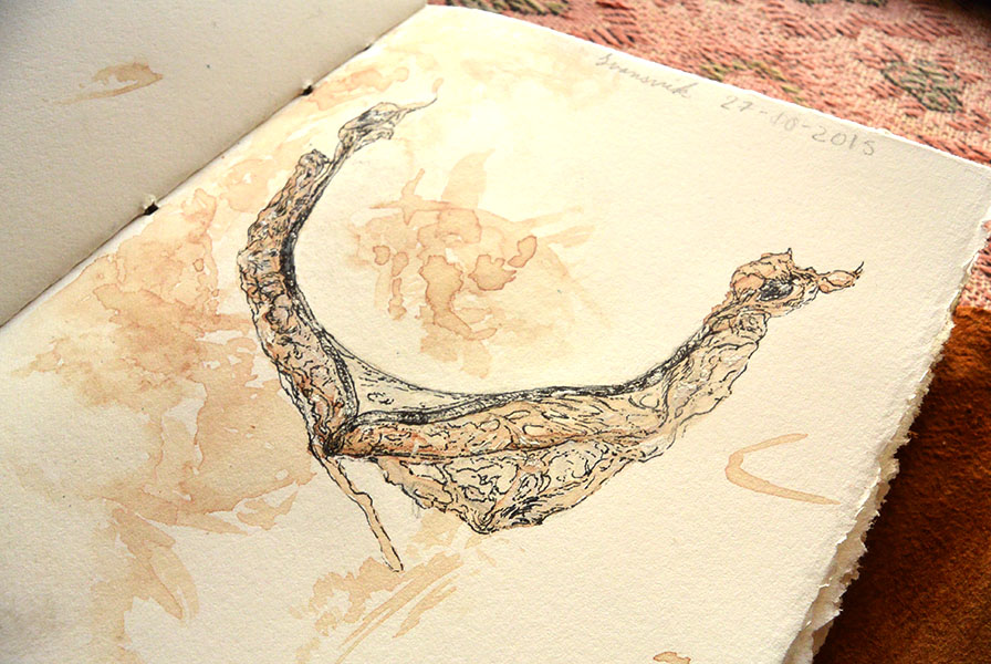 The black band just to the right of the uterus' center is the half-scar indicating a fetus not carried to term