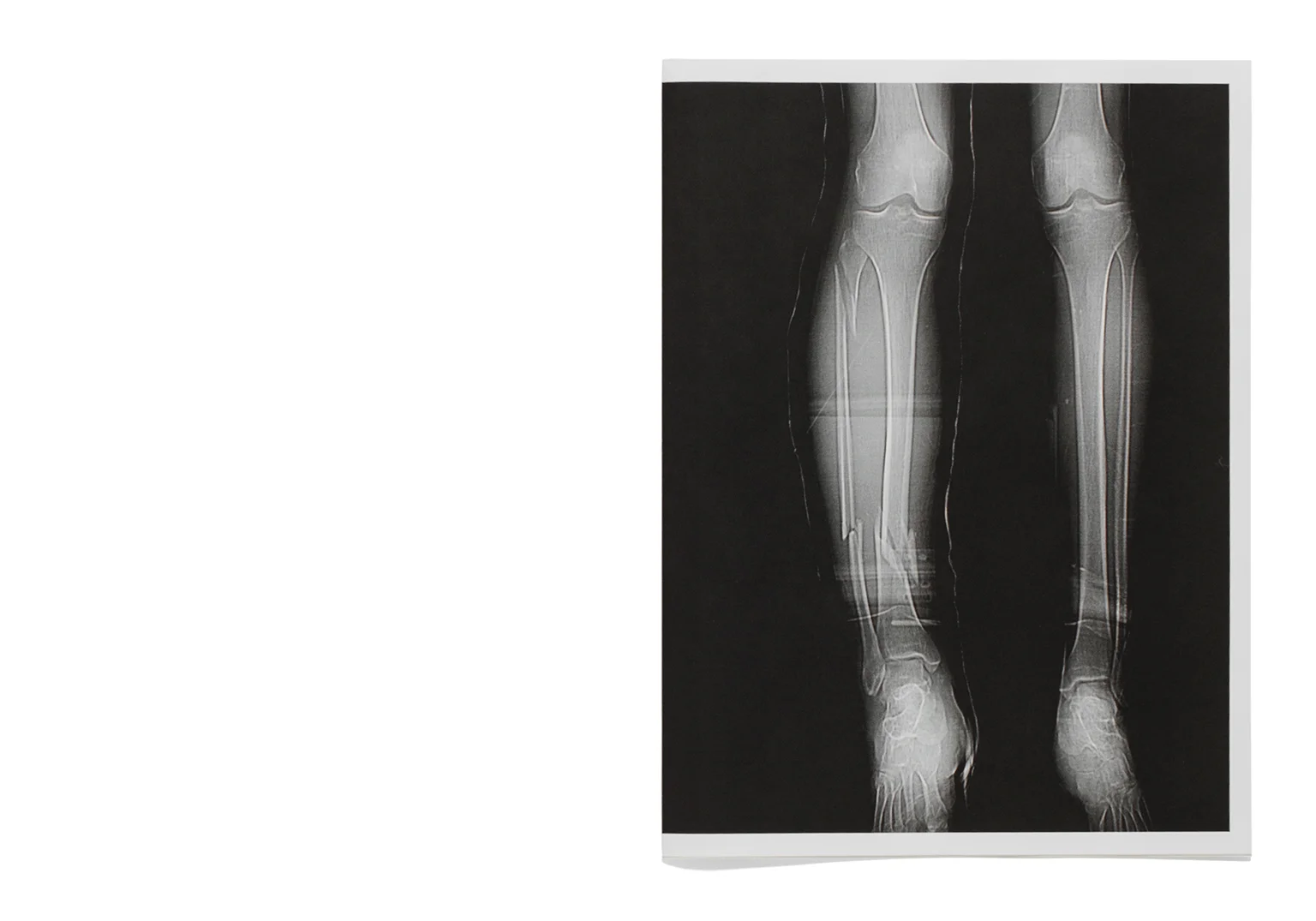 LEG_01_FrontCover.jpg