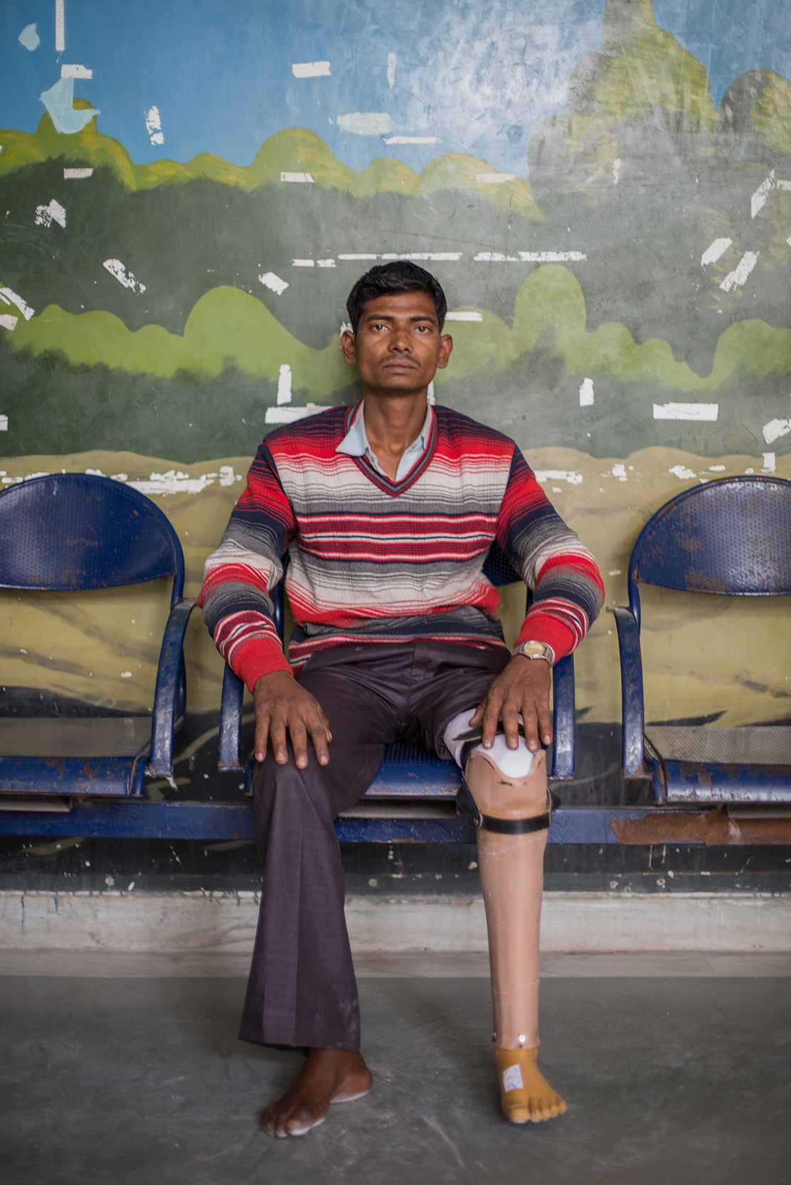  Gopesh was 16 years old when a wall collapsed on his leg, causing him to lose his left limb. This was his first visit to BMVSS seeking a hand-pedaled tricycle for more efficient mobility. Gopesh is 24 years old. 