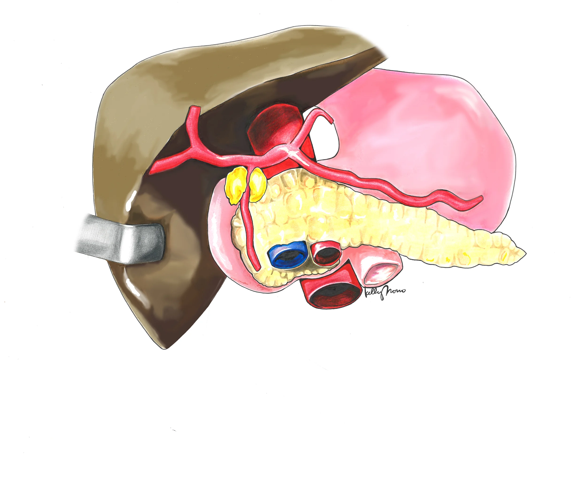 HAGDApancsideview.ill.2015.jpg