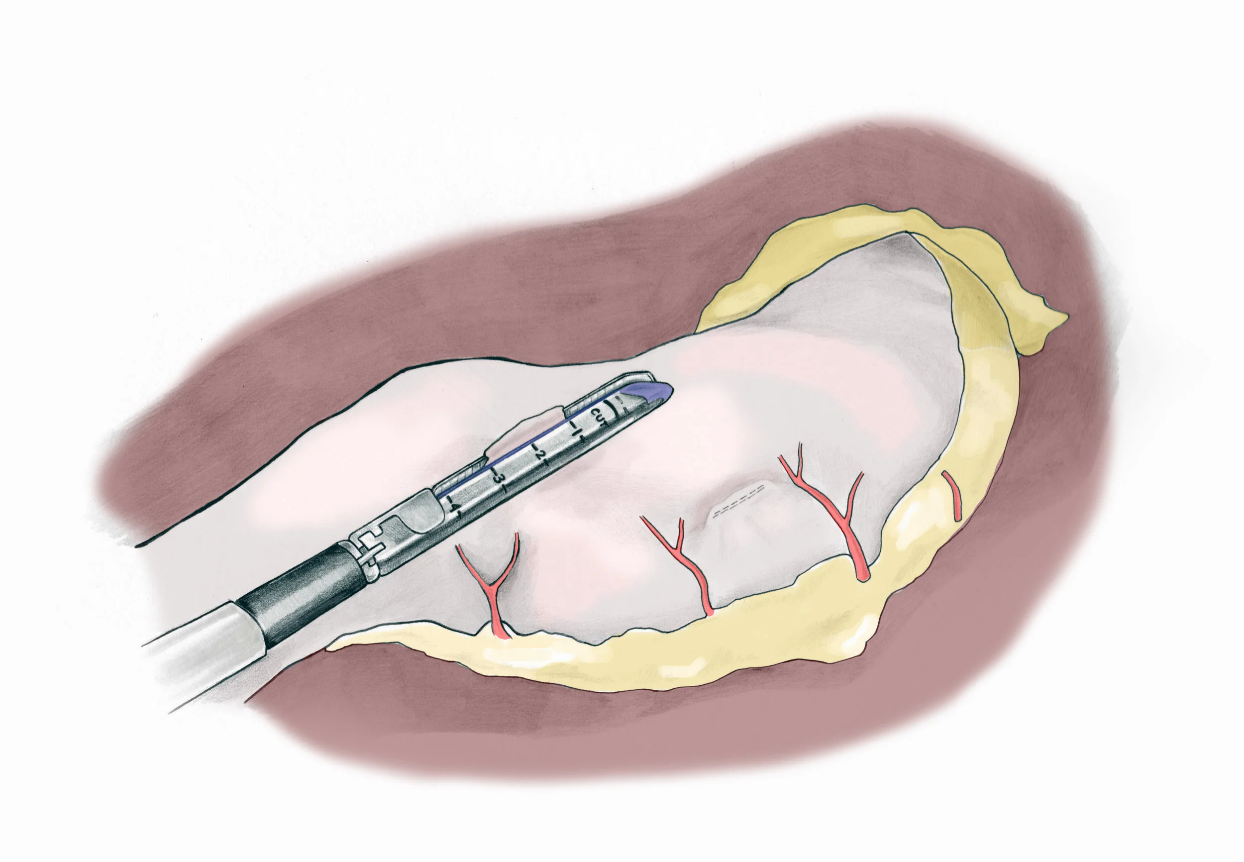 fig5copy.jpg