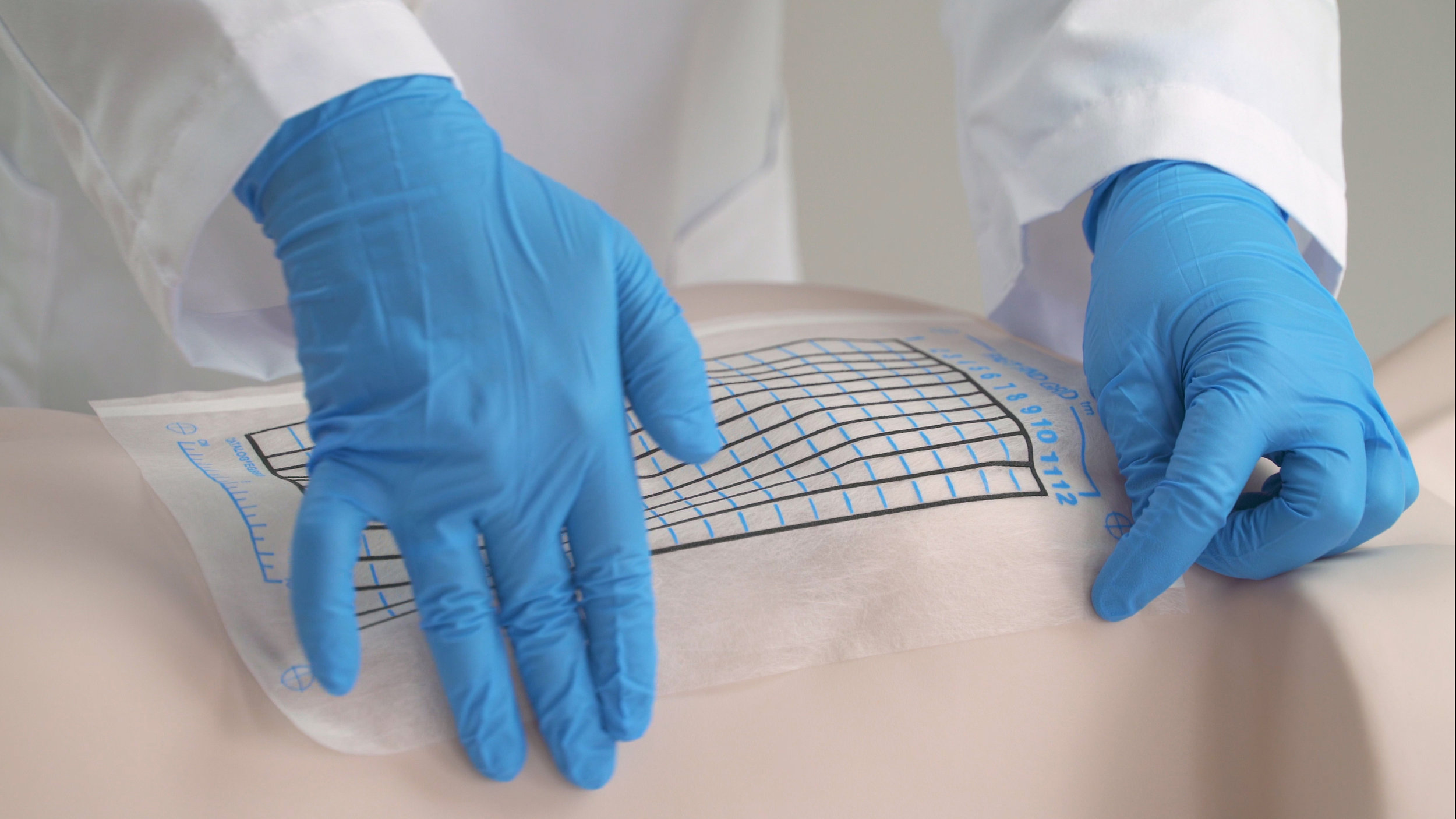 The Fast Find Grid: CT Guided Biopsy Grid — Webb Medical