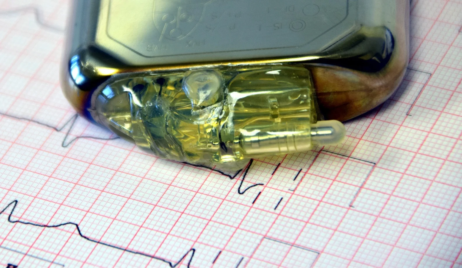 pacemaker-1943662_1920.jpg