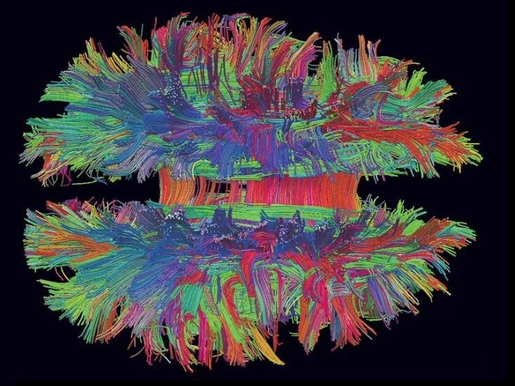 diffusionmri.jpg