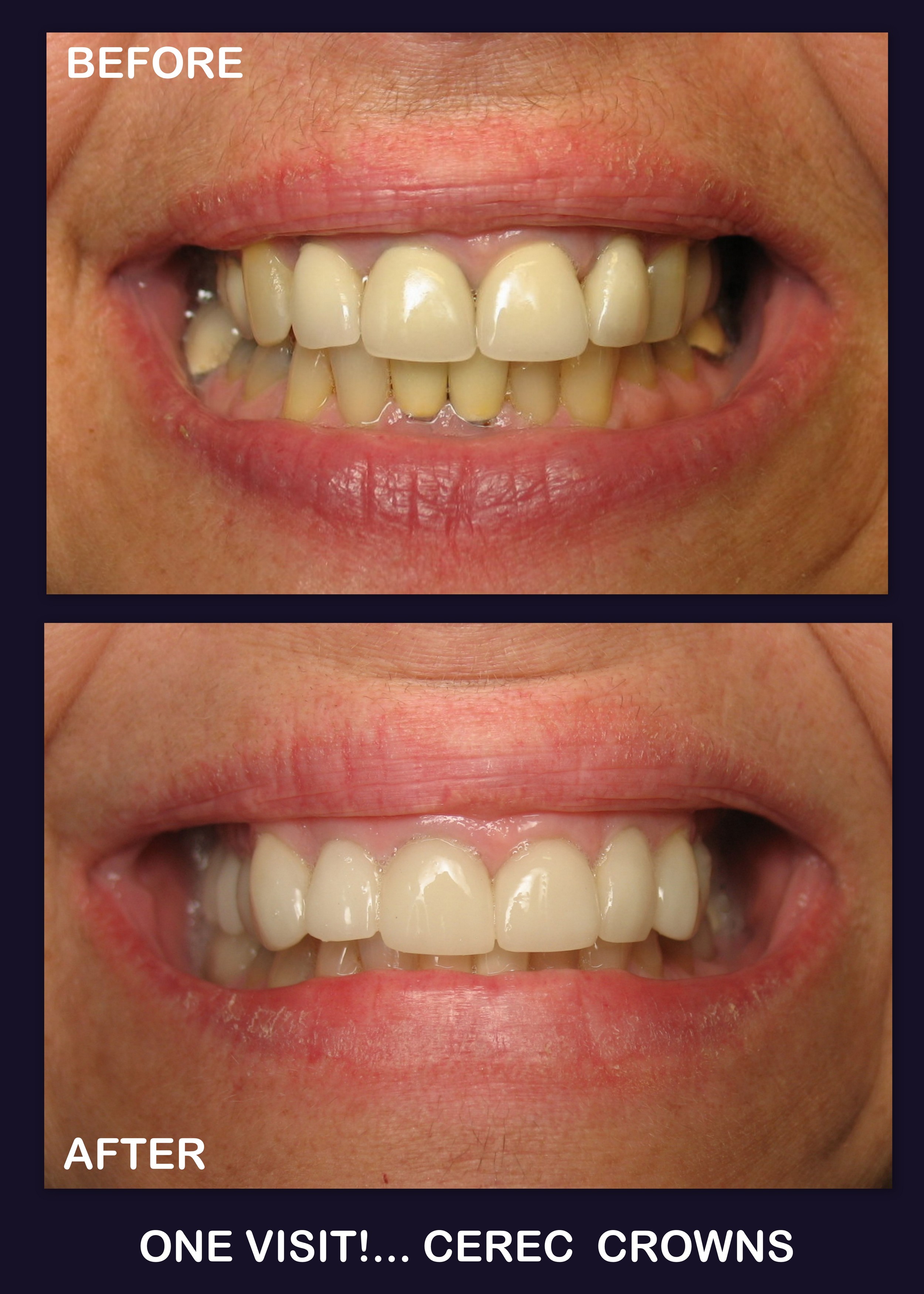 CEREC (1a).jpg