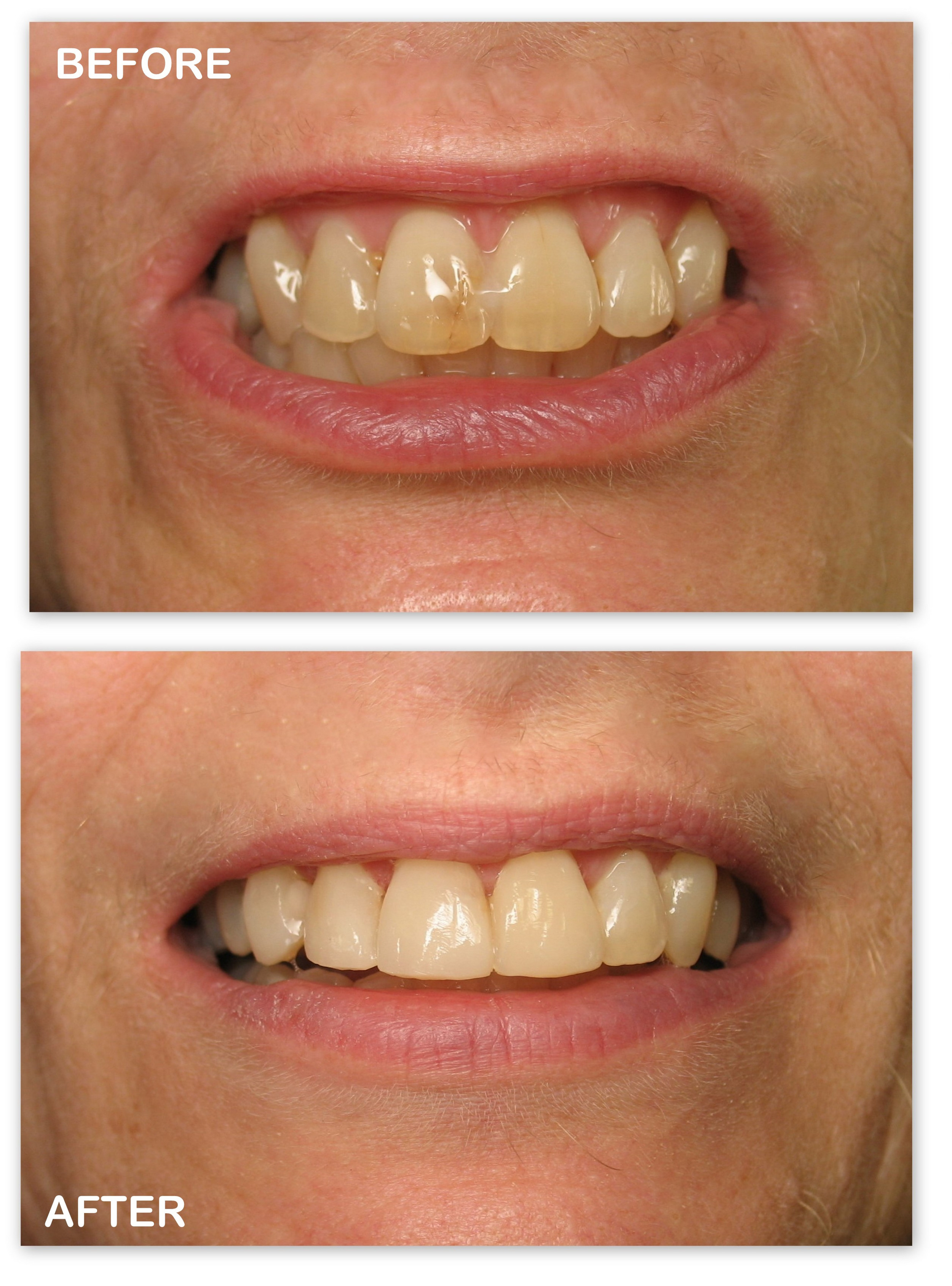 Cos Bdg (To Whiten Teeth) (2).jpg