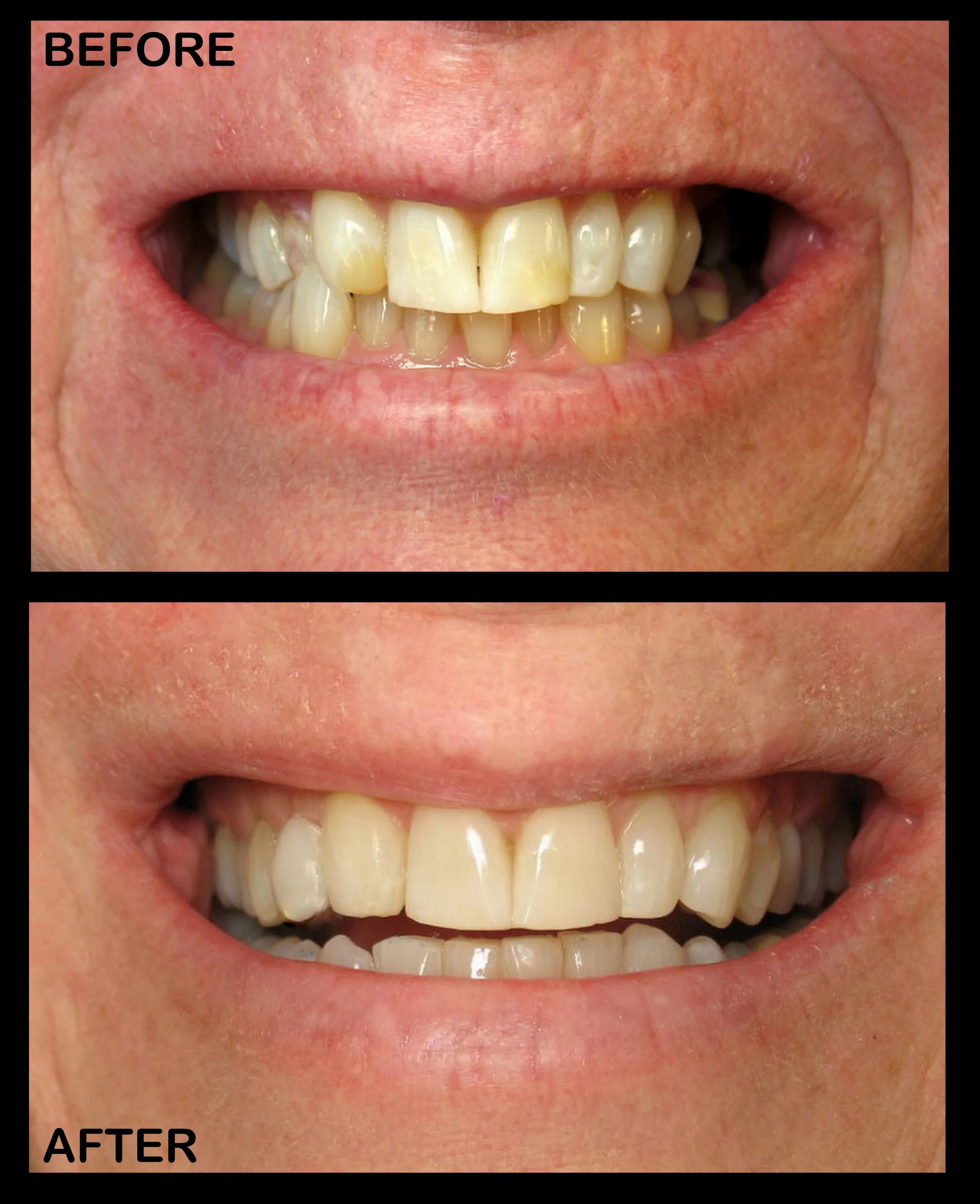 Bad Teeth Before And After bad-teeth-before-and-after