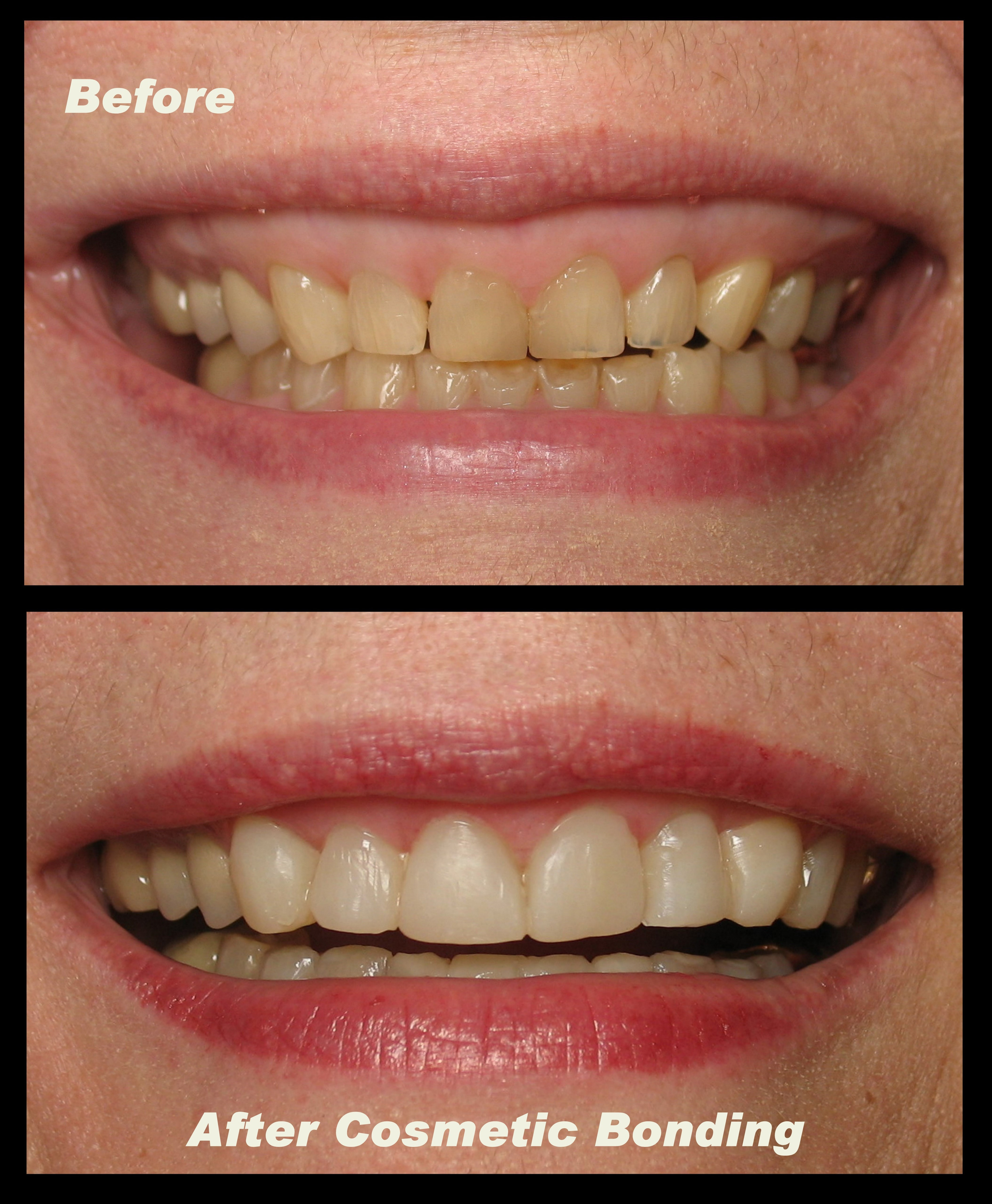 Cocopull Oil Pulling For White Teeth Fresh Breath And Healthy Gums Coconut Oil Pulling Benefits Coconut Oil For Teeth Oil Pulling Benefits