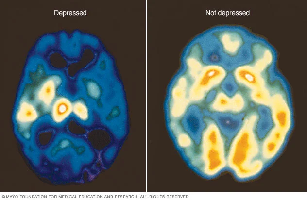 c7_pet_depression-8col.ashx.jpg