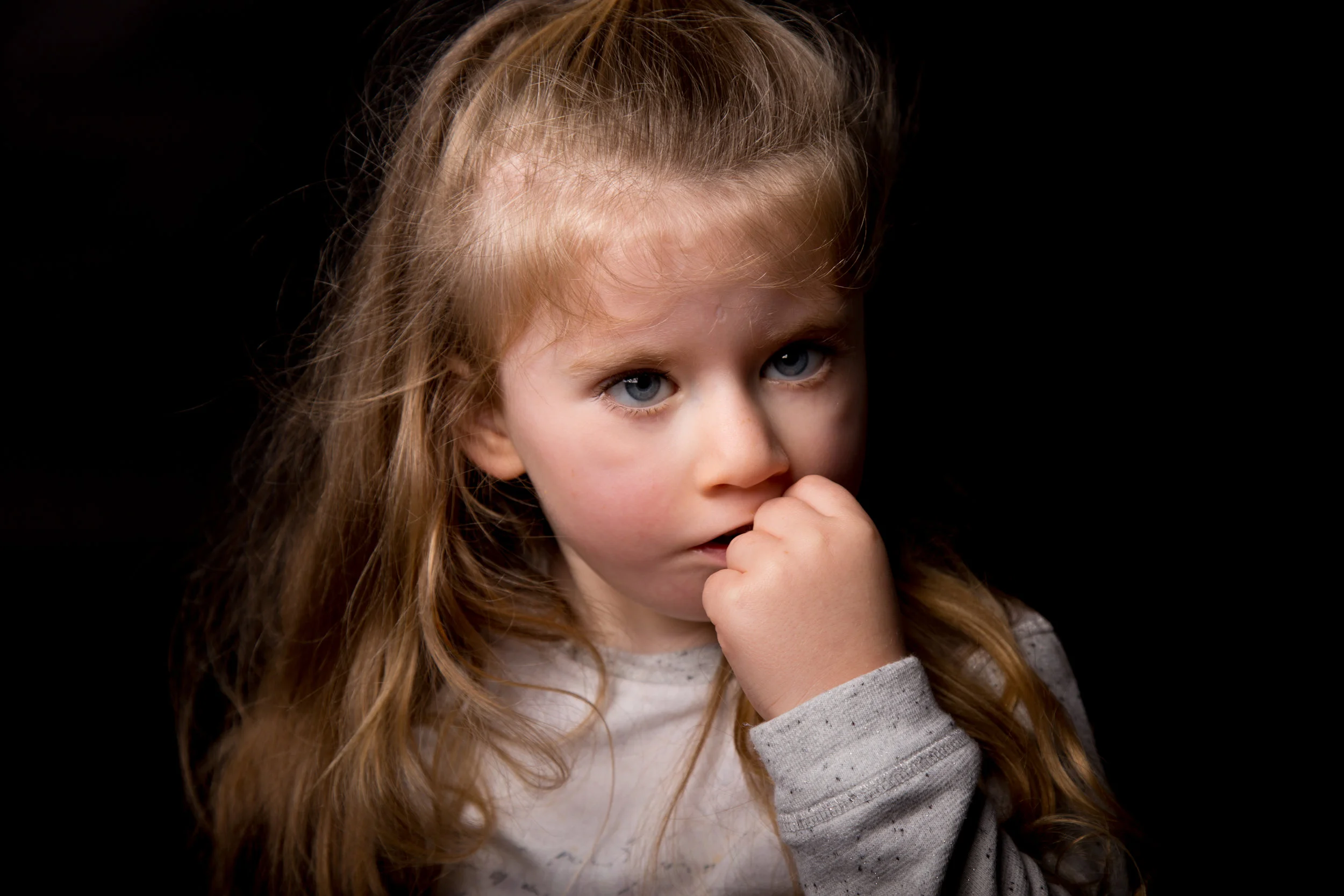 Isabella has Moebius Syndrome