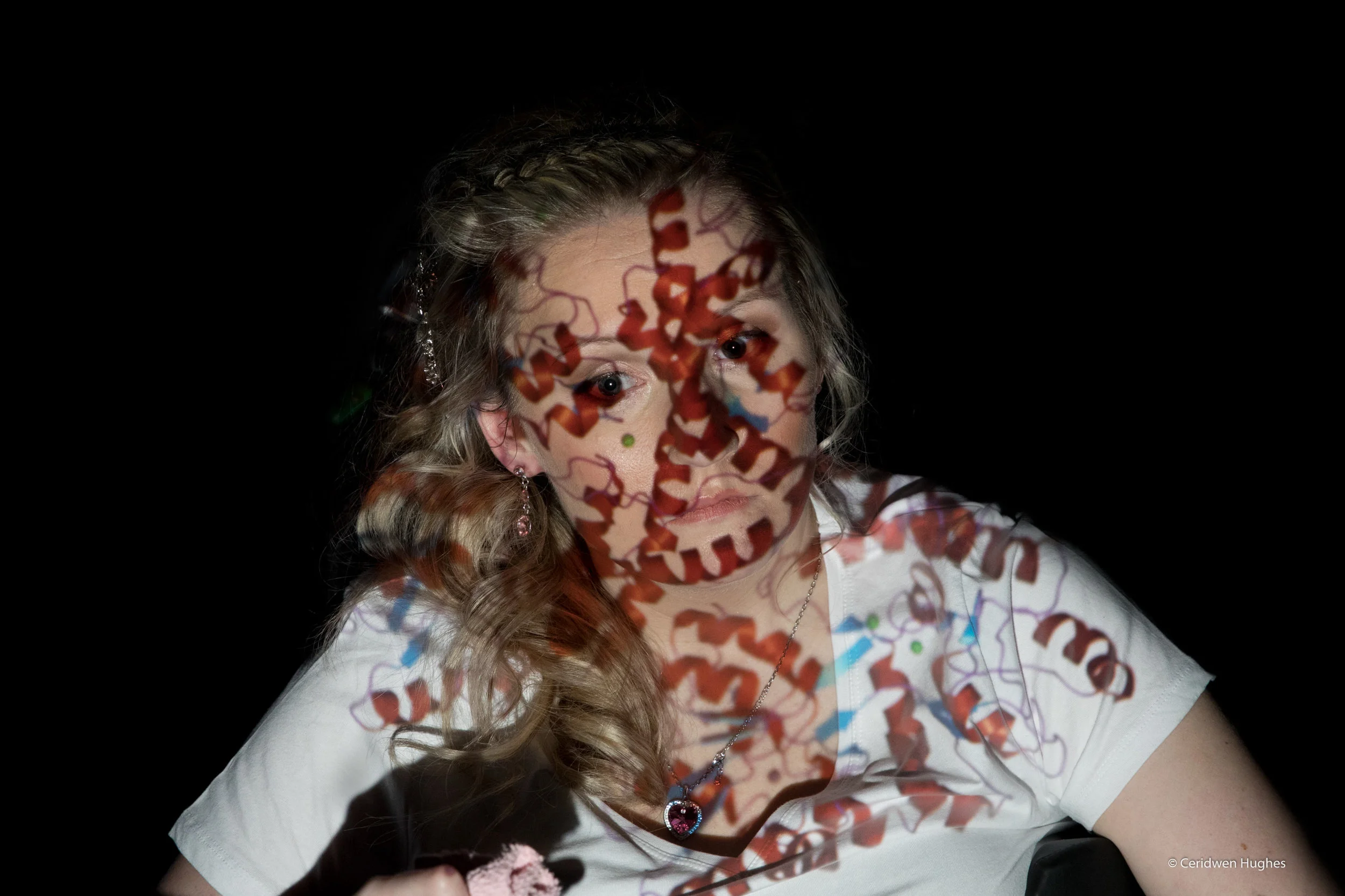 The gene that causes Huntington’s is often called the huntingtin gene. It is attached to a chromosome number 4. It produces an important protein, called huntingtin, which is needed by nerve cells in the brain (neurons) and for the body’s development before birth. In this image, the huntingtin protein is projected onto Lizzie. When the huntingtin gene is faulty, the protein it produces repeats certain genetic sequences too many times. This in turn appears to damage neurons in certain areas of the brain - although how and why this happens is not yet fully understood.