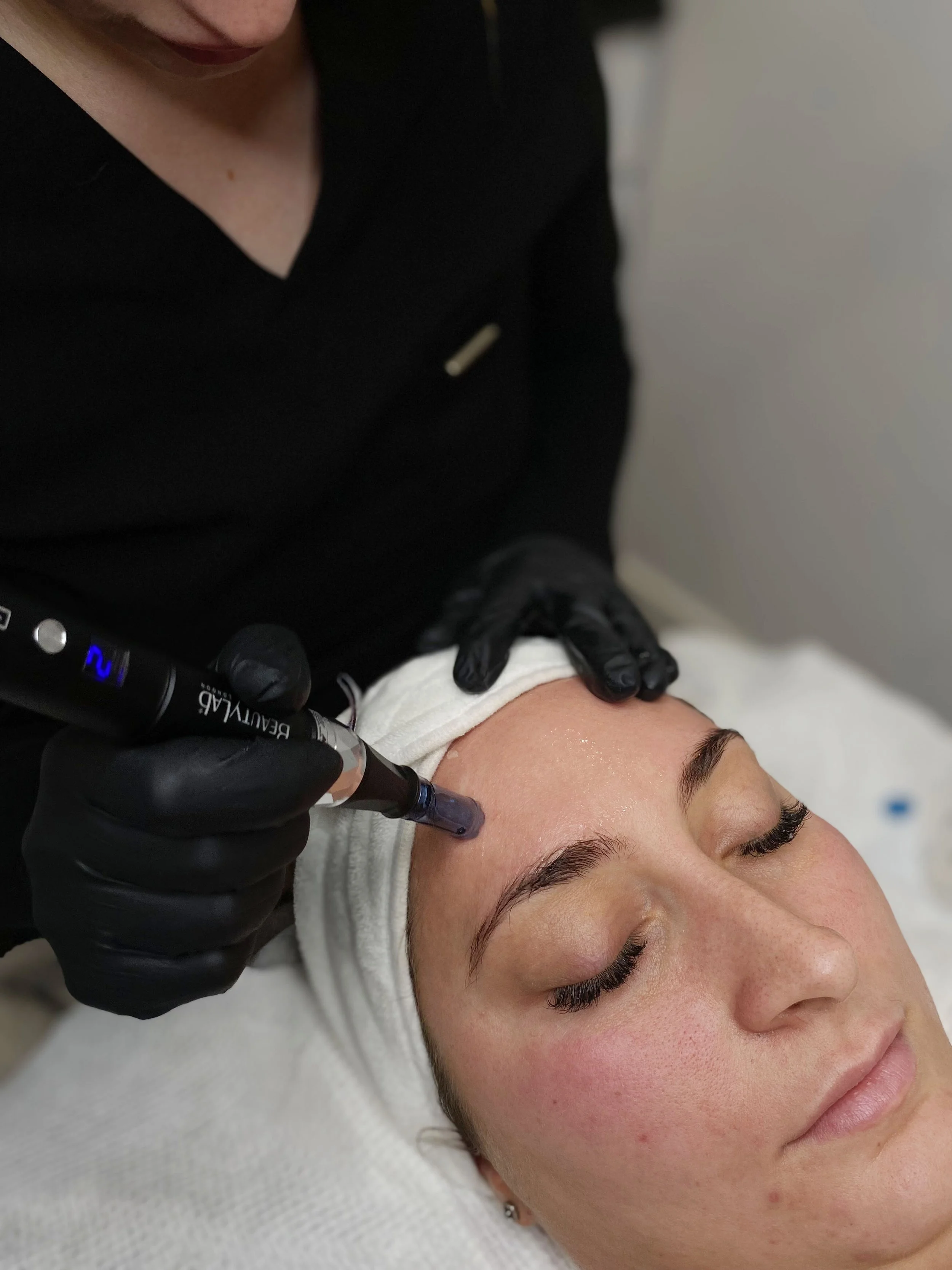 Photo one mirconeedling .jpg