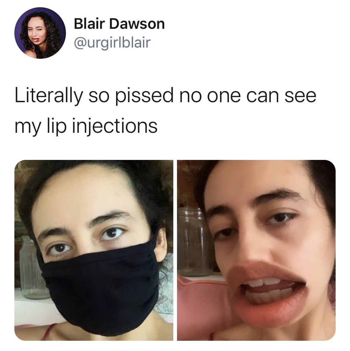 lipinject_tweet.PNG