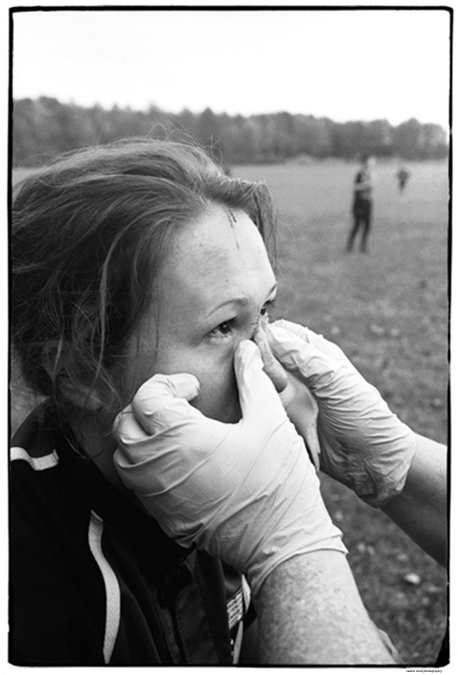 SPORTS | Nose Injury, Rugby, Gambier, Ohio