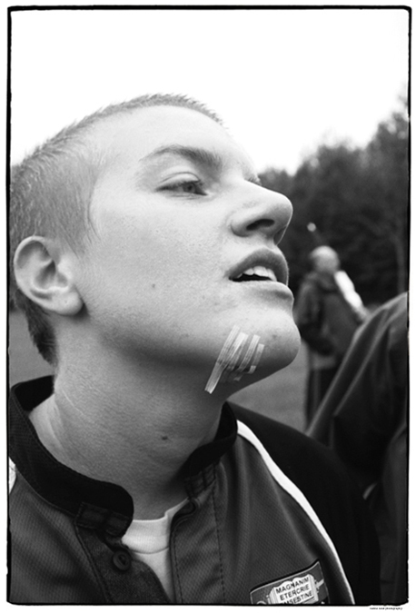 SPORTS | Chin Laceration, Rugby, Gambier, Ohio