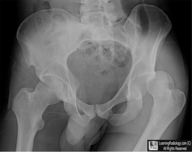 Identify the Condition