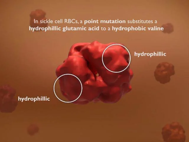 Hemoglobin in Sickle Cell