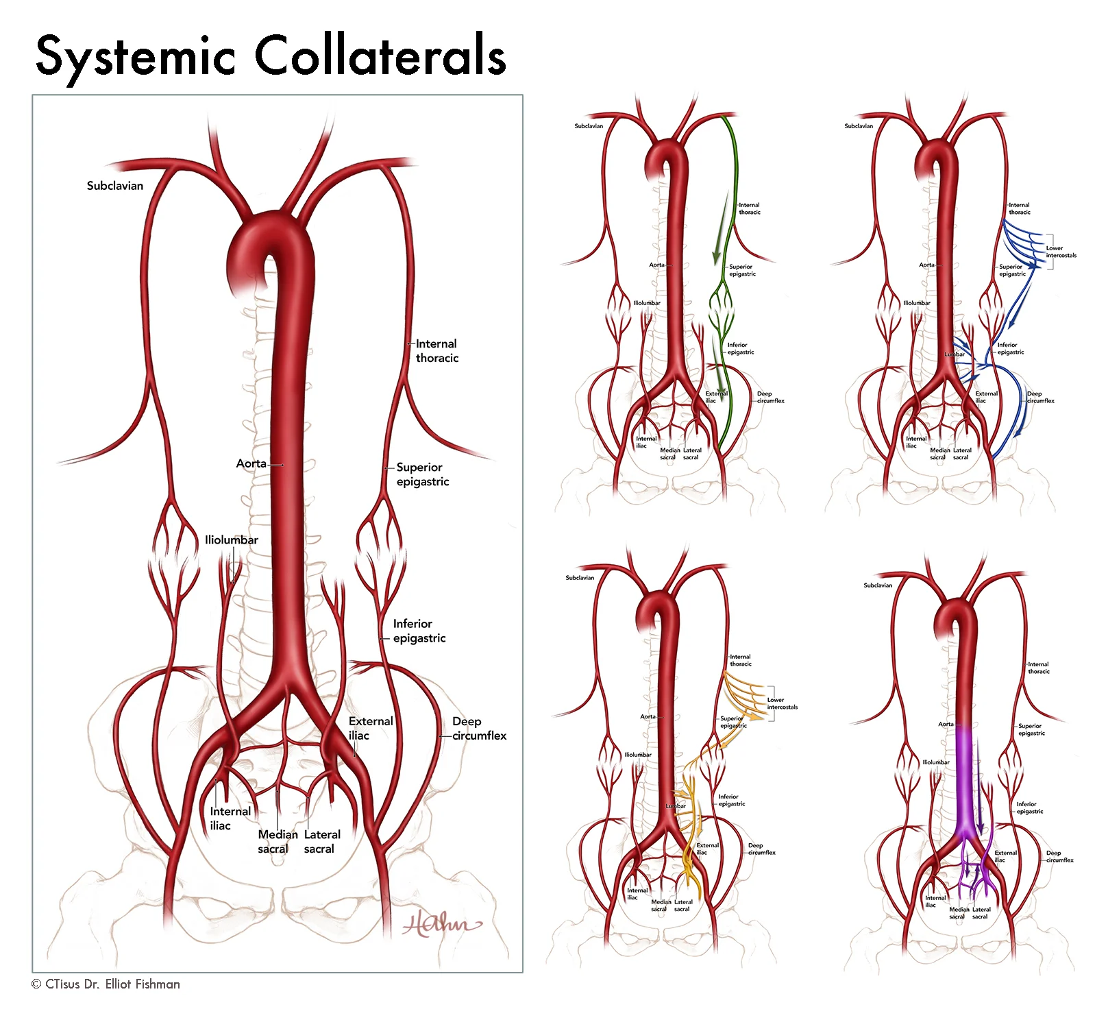 Systemic Collaterals