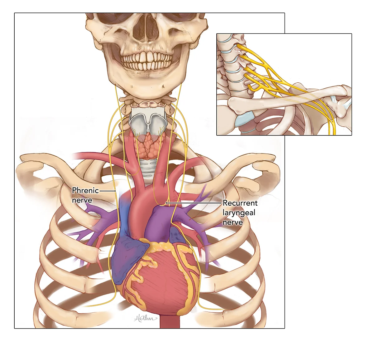 4_RecurrentLaryngeal_BrachialPlexus.jpg