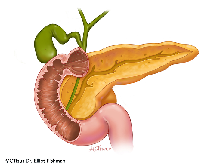 Желчный пузырь сахарный диабет. Поджелудочная железа pancreas. Рисунок поджелудочной железы человека. Веселая поджелудочная железа.