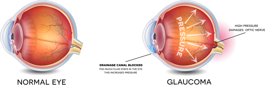 retinalyzeimage.png