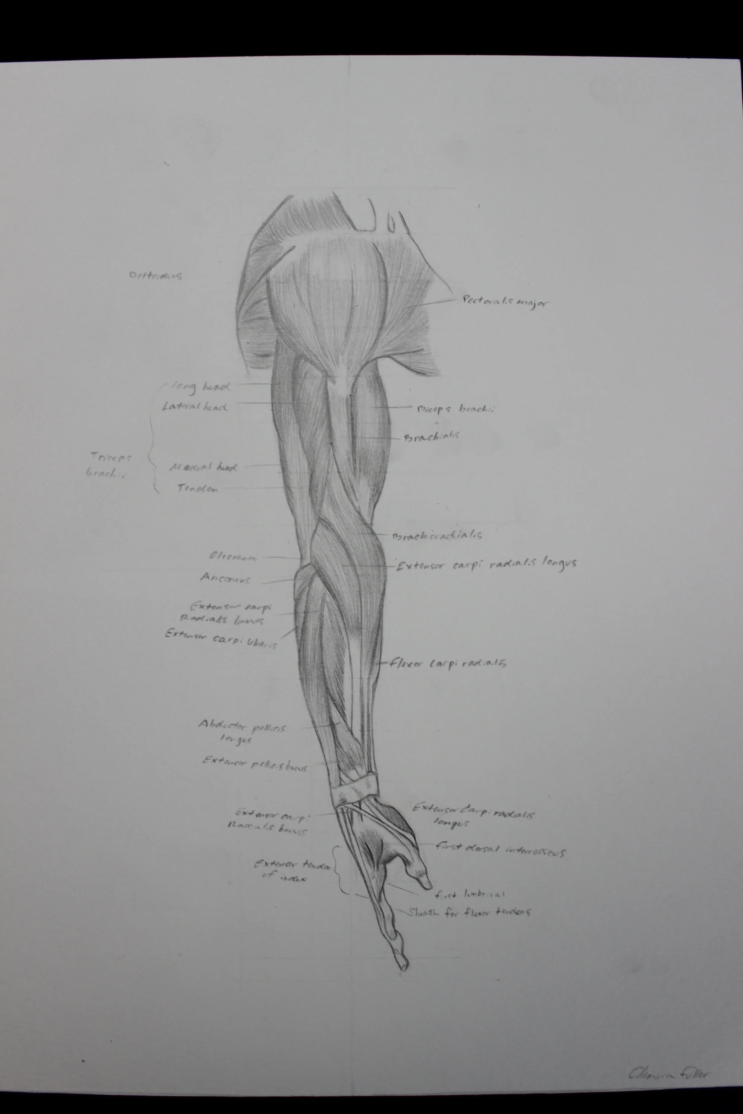 Arm (Anatomy)