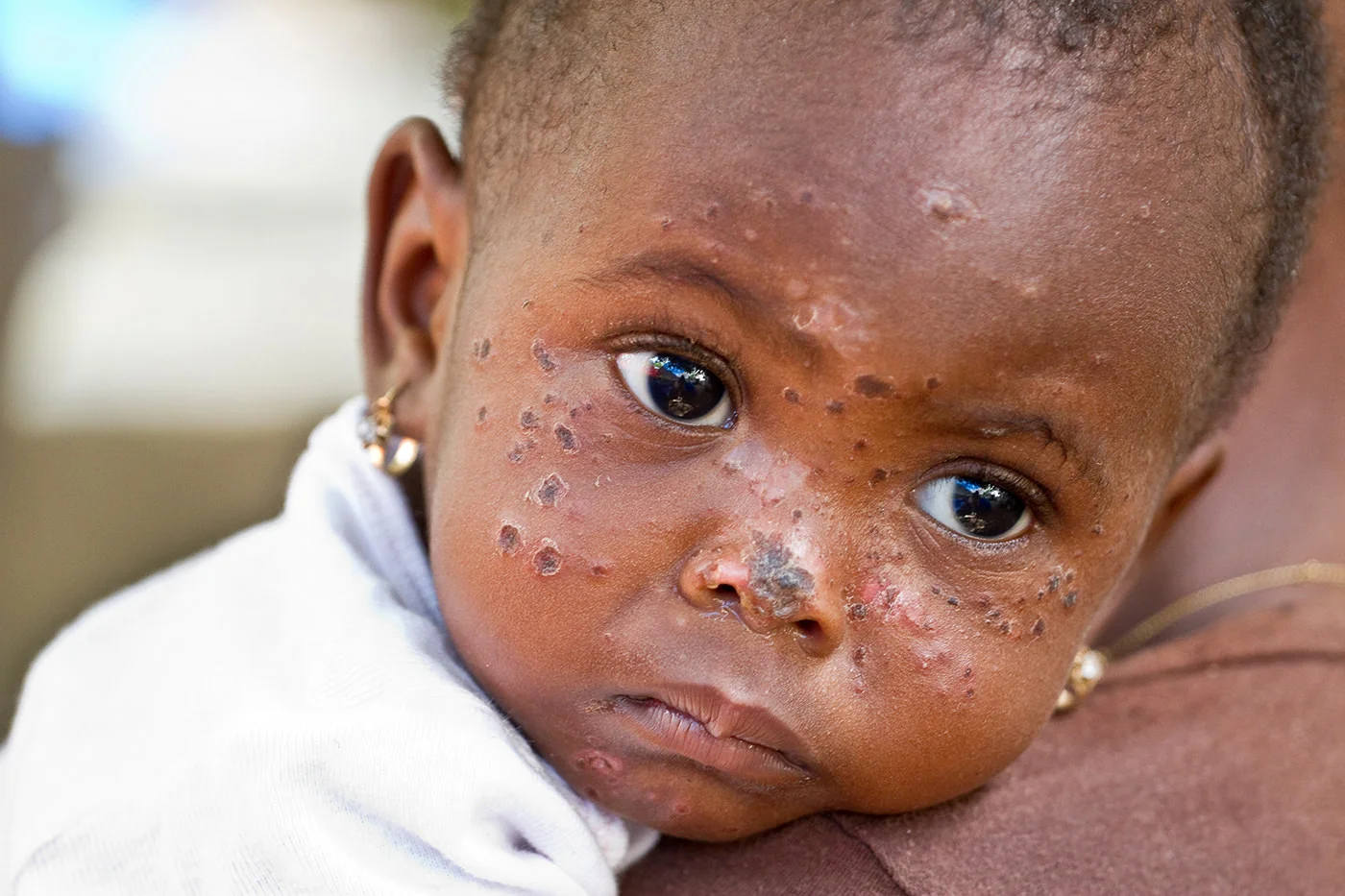 Port-au-Prince, Haiti - 60 days later
