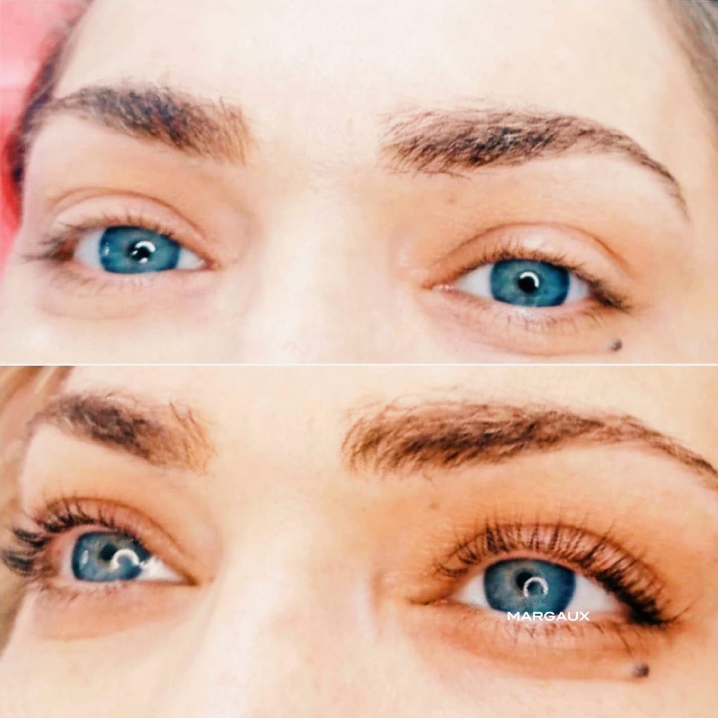 LASH LIFT before &amp; after