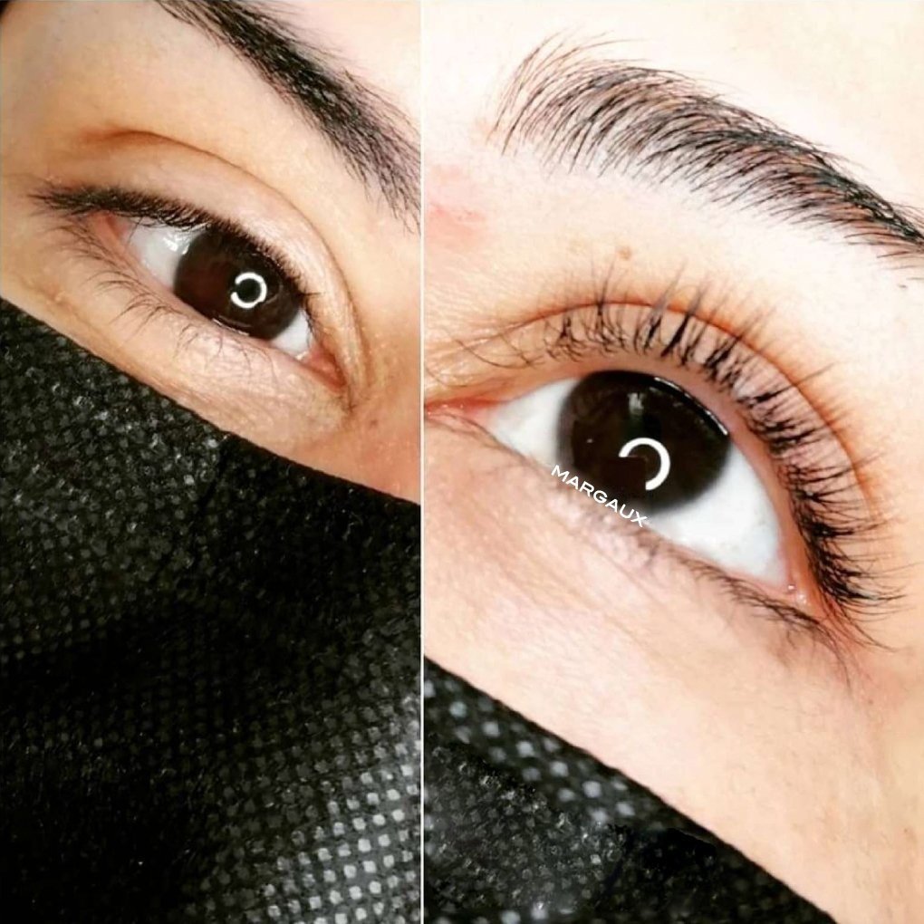 LASH LIFT   before &amp; after